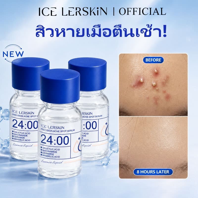 ICE LERSKIN Salicylic Acid Serum 10ml เซรั่มลดสิว คุมมัน กระชับรูขุมขน ผิวเรียบเนียน ใช้ได้ทุกวัน
