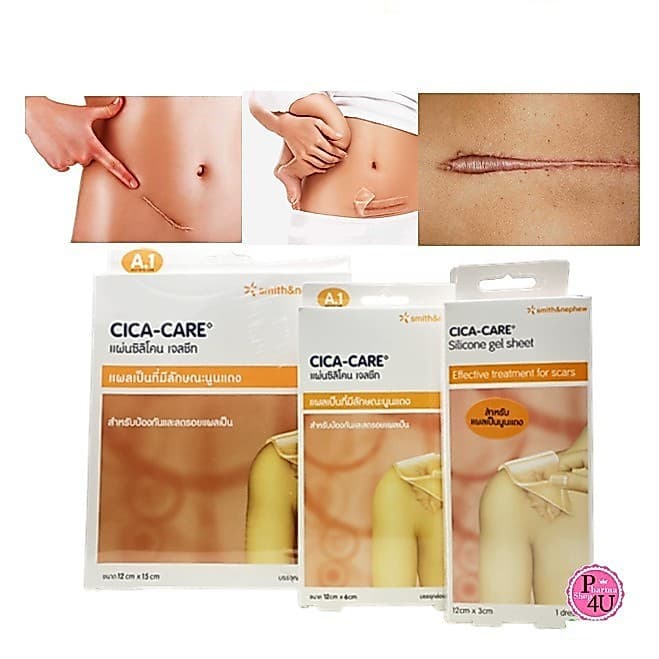 แผ่นซิลิโคน เจลชีท CICA-CARE ลดรอยแผลเป็น cica care Keloid kelopad