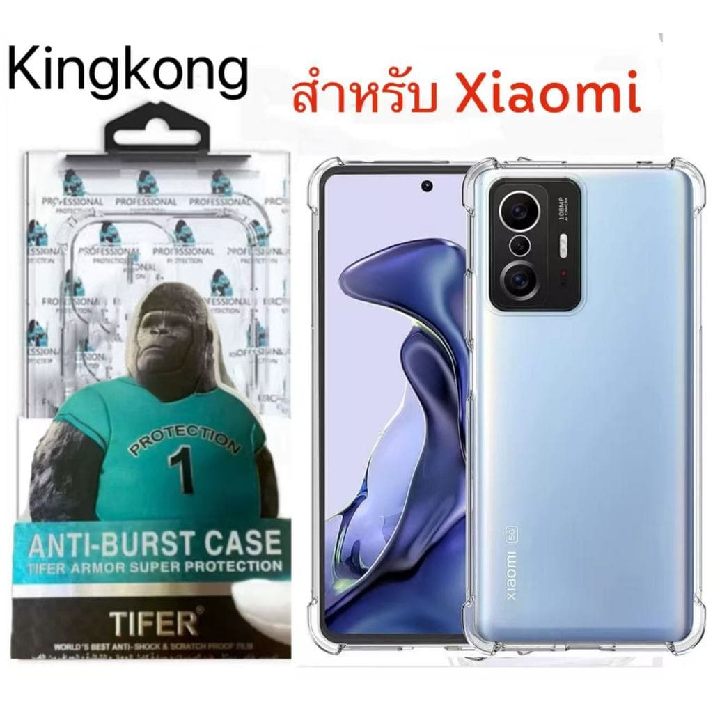 เคสใส คิงคอง สําหรับ Xiaomi Mi17T Pro Mi15T Mi15Tpro Mi14T Mi14Tpro Mi12T Mi12Tpro Mi11T Mi11Tpro Mi10T…