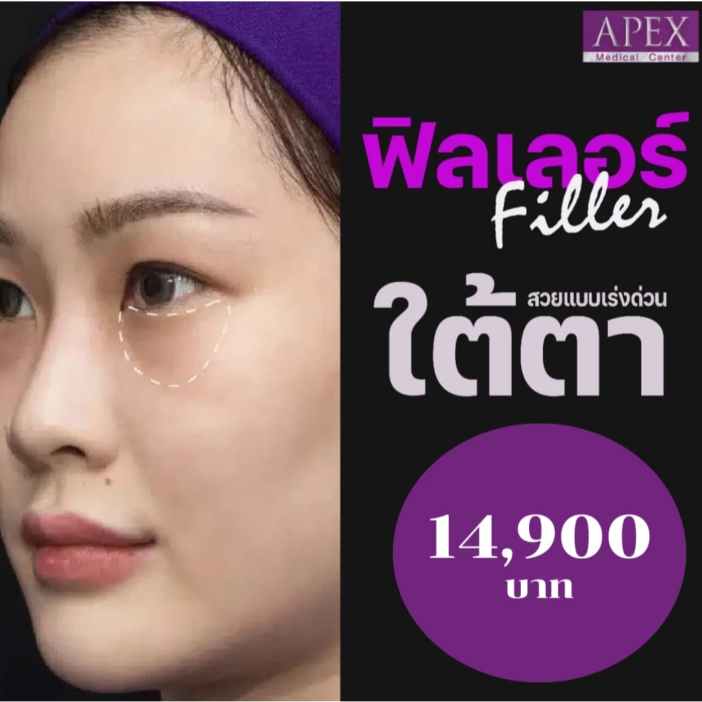 APEX Filler ฟิลเลอร์ USA ใต้ตา หน้าดูเด็กลงได้หลายปี (Filler ใดก็ได้ สามารถเลือกทําได้)