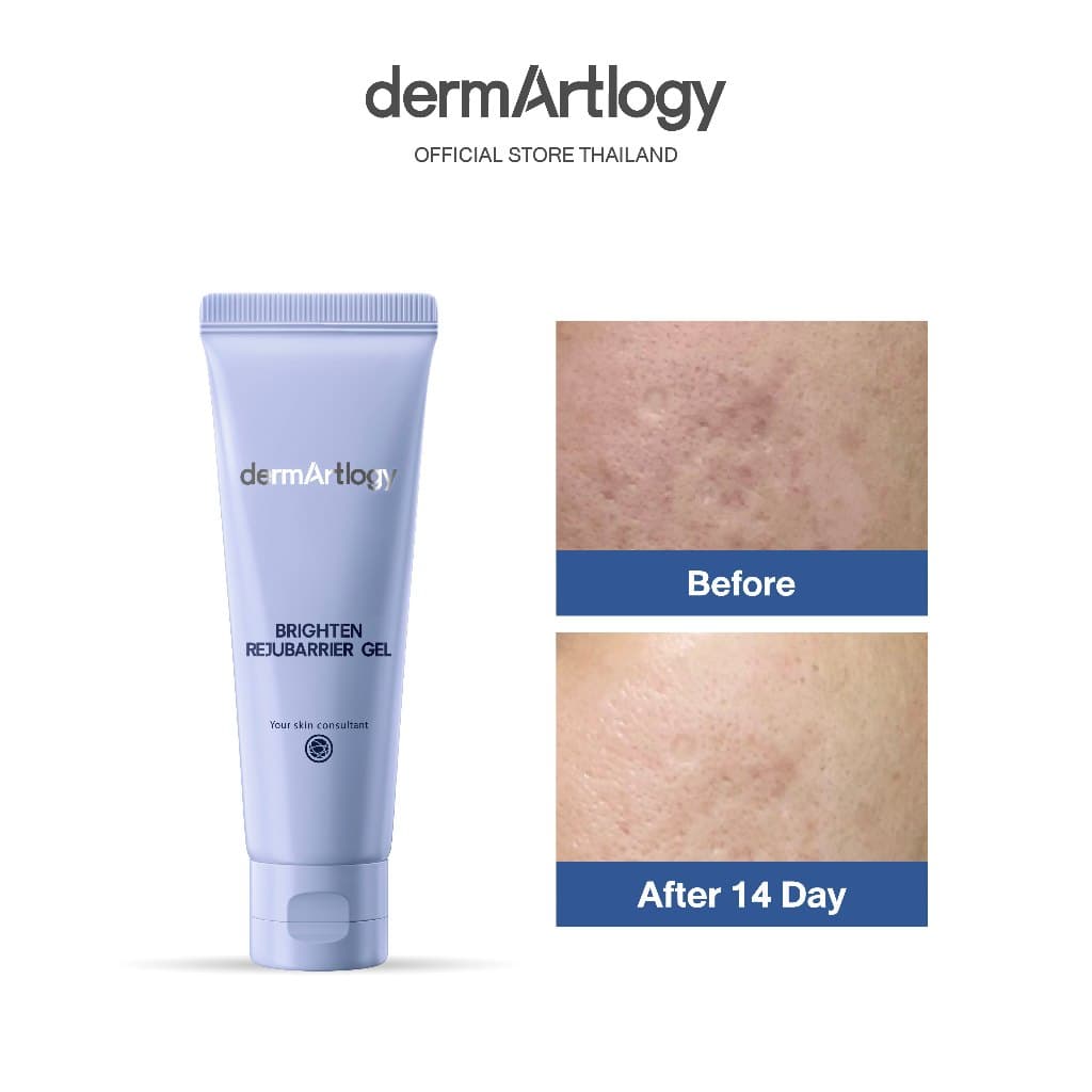DermArtlogy Brighten Rejubarrier Gel 50 ml มอยส์เจอไรเซอร์เนื้อเจล ผิวแพ้ง่าย ผิวหมองคล้ํา เสริมเกราะผิว…