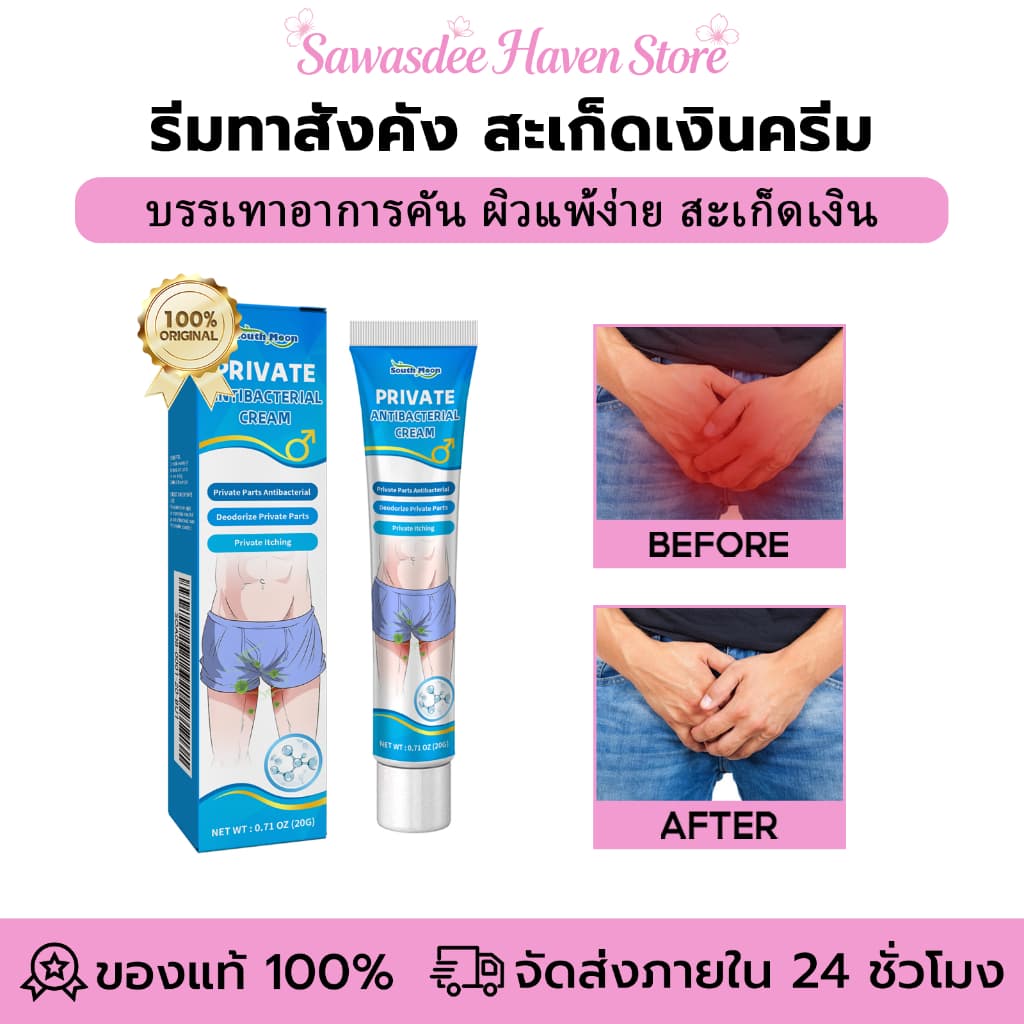 South Moon ครีมทาสังคัง สะเก็ดเงินครีม ครีมบํารุงผิว 20g ทาแก้อาการคันในร่มผ้า ทากากเกลื้อน รักษาสังคัง…