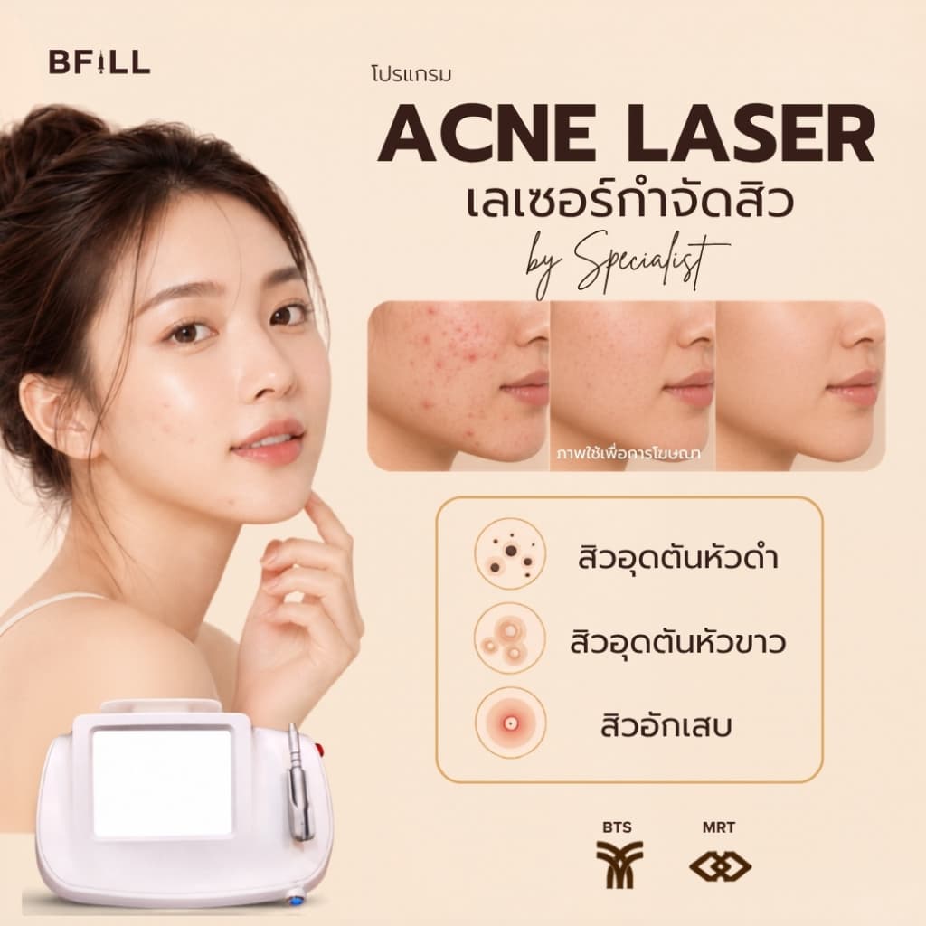 BFiLL โปรเเกรมเลเซอร์กําจัดสิว Acne Laser by Specialist Only Asok ดูแลปัญหาสิวที่ต้นตอ รักษาสิว ลดสิว…