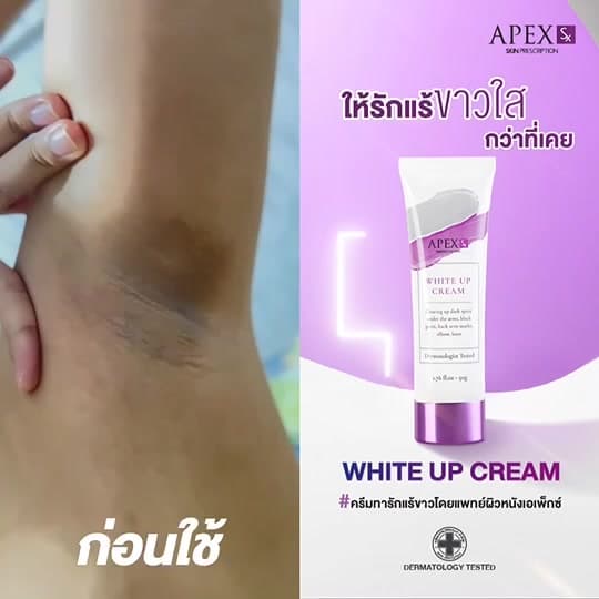 APEX-SX WHITE UP CREAM ครีมทารักแร้ขาว โดยแพทย์ผิวหนังเอเพ็กซ์ ทาขาหนีบดำ แก้มก้นดำ 50 ml.