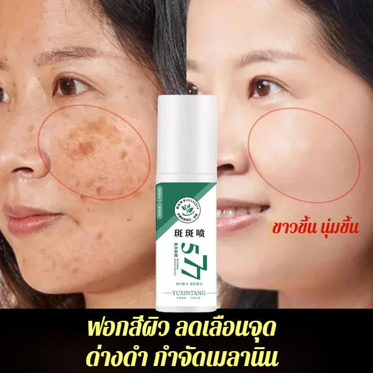 ฟื้นฟูผิว เอสเซนส์ต่อต้านกระ เอสเซนส์การดูแลผิว ไวท์เทนนิ่ง กําจัดกระ และให้ความชุ่มชื้น มีประสิทธิภาพ… รูปที่ 1