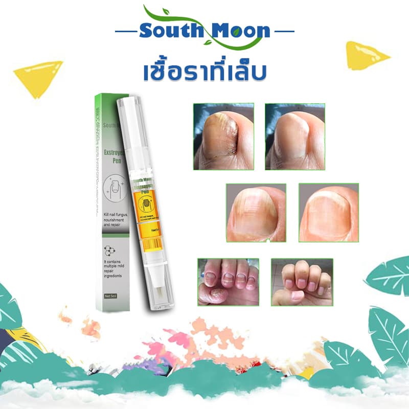 South Moon ซ่อมเล็บ เซรั่มรักษาเล็บ บำรุงเล็บ ยาเชื้อราเล็บ รักษาเชื้อราที่เล็บ ห่างกับปัญหาเล็บ รูปที่ 1