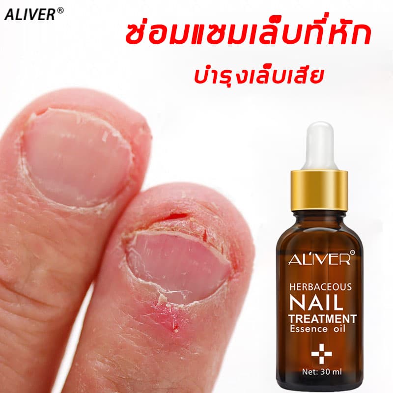 ของแท้ 100% Aliver เซรั่มบำรุงเล็บ น้ำยาบำรุงเล็บ 30ml บำรุงเล็บ ต่อต้านการติตเชื้อรา ซ่อมแซมเล็บแตก… รูปที่ 1