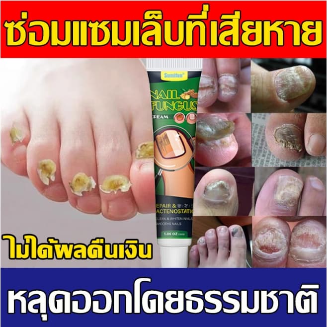 ของแท้100% เซรั่มบำรุงเล็บ 30g ฆ่าเชื้อราที่เล็บ น้ำยารักษาเล็บ เซรั่มบำรุงเล็บ ครีมบำรุงเล็บ เซรั่มรักษาเล็บ รูปที่ 1