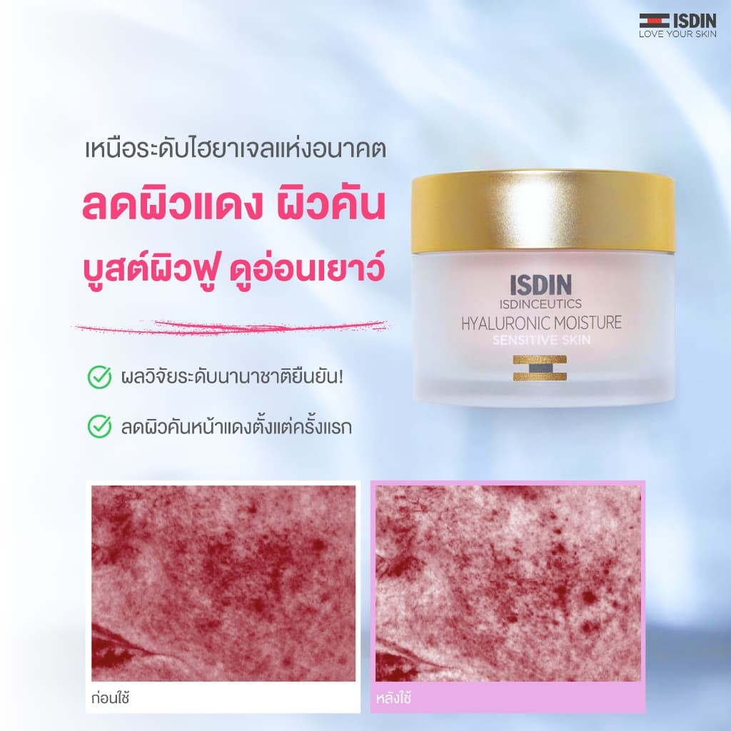 HYALURONIC MOISTURE SENSITIVE เจลครีมลดผิวแดง หน้าแสบตั้งแต่ครั้งแรกที่ใช้ พร้อมดูแล 7 สัญญาณผิวเสียแห่งวัย รูปที่ 1