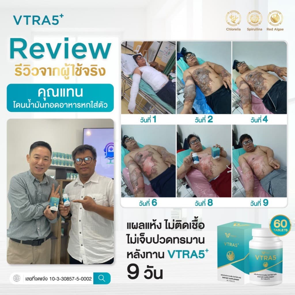 VTRA5 สามารถปรับสมดุลความผิดปกติของเซลล์ในกลุ่มโรค 3 กลุ่ม รูปที่ 1