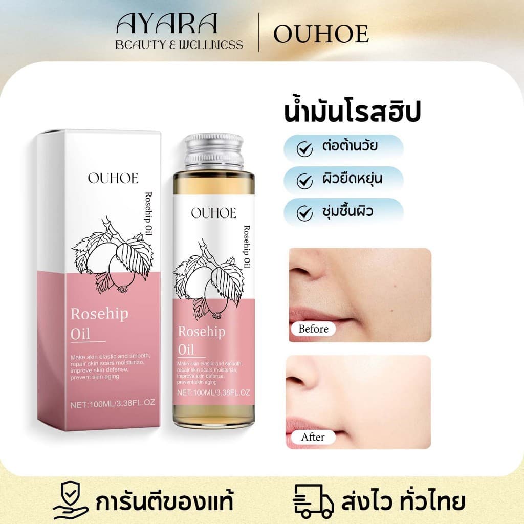 OUHOE ออยล์บำรุงผิวกาย น้ำมันบำรุงผม น้ำมันนวด เซรั่มซ่อมผมเสีย ความงามและการดูแลผิว… รูปที่ 1