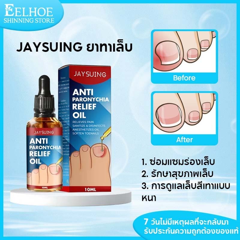 Jaysuing ยาทาเล็บขบ 10ml เซรั่มเล็บขบ เล็บขบnail serum ยาเล็บขบ กันเล็บขบ บํารุงเล็บ เซรั่มซ่อมแซมเล็บแทรก รูปที่ 1