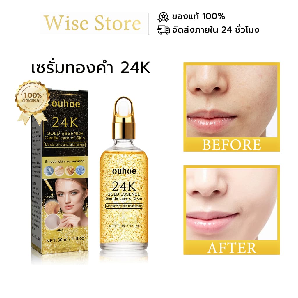 OUHOE เซรั่มบำรุงผิวหน้าทองคำ 24kลดเลือนริ้วรอย เติมน้ำ ทำให้ผิวกระจ่างใส ปรับปรุงการอบแห้ง… รูปที่ 1