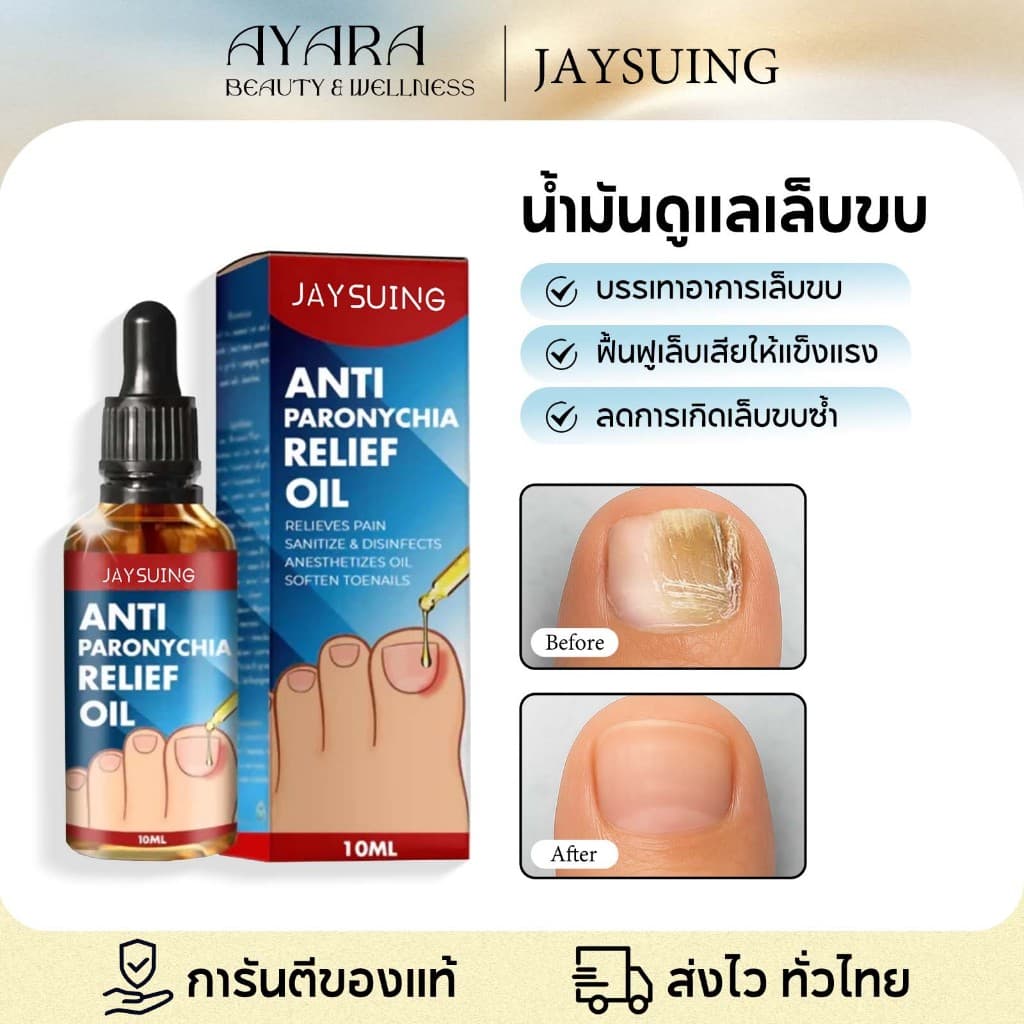 Jaysuing น้ํายาปรับเล็บขบ ปรับเล็บขบ โรคติดเชื้อที่ขอบเล็บ เล็บแตก ซ่อมแซมเล็บ รักษาเชื้อราที่เล็บ เล็บอักเสบ รูปที่ 1