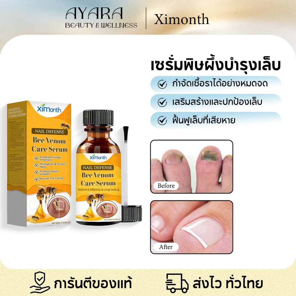 Ximonth น้ำยารักษาเชื้อราที่เล็บ ฆ่าเชื้อราที่เล็บ บำรุงเล็บ เชื้อราเล็บเชื้อราที่เล็บฆ่าเชื้อราเล็บ รูปที่ 1