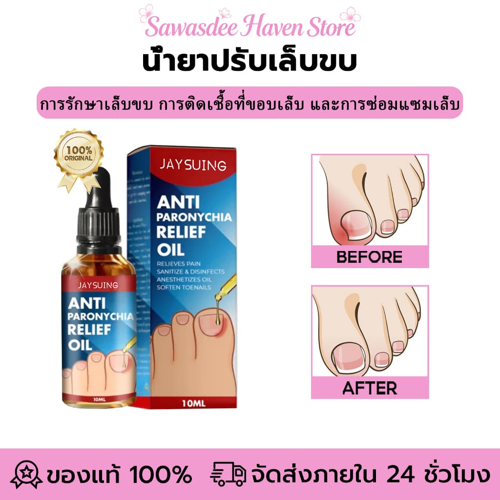 Jaysuing น้ํายาปรับเล็บขบ ปรับเล็บขบ โรคติดเชื้อที่ขอบเล็บ เล็บแตก ซ่อมแซมเล็บ รักษาเชื้อราที่เล็บ เล็บอักเสบ รูปที่ 1