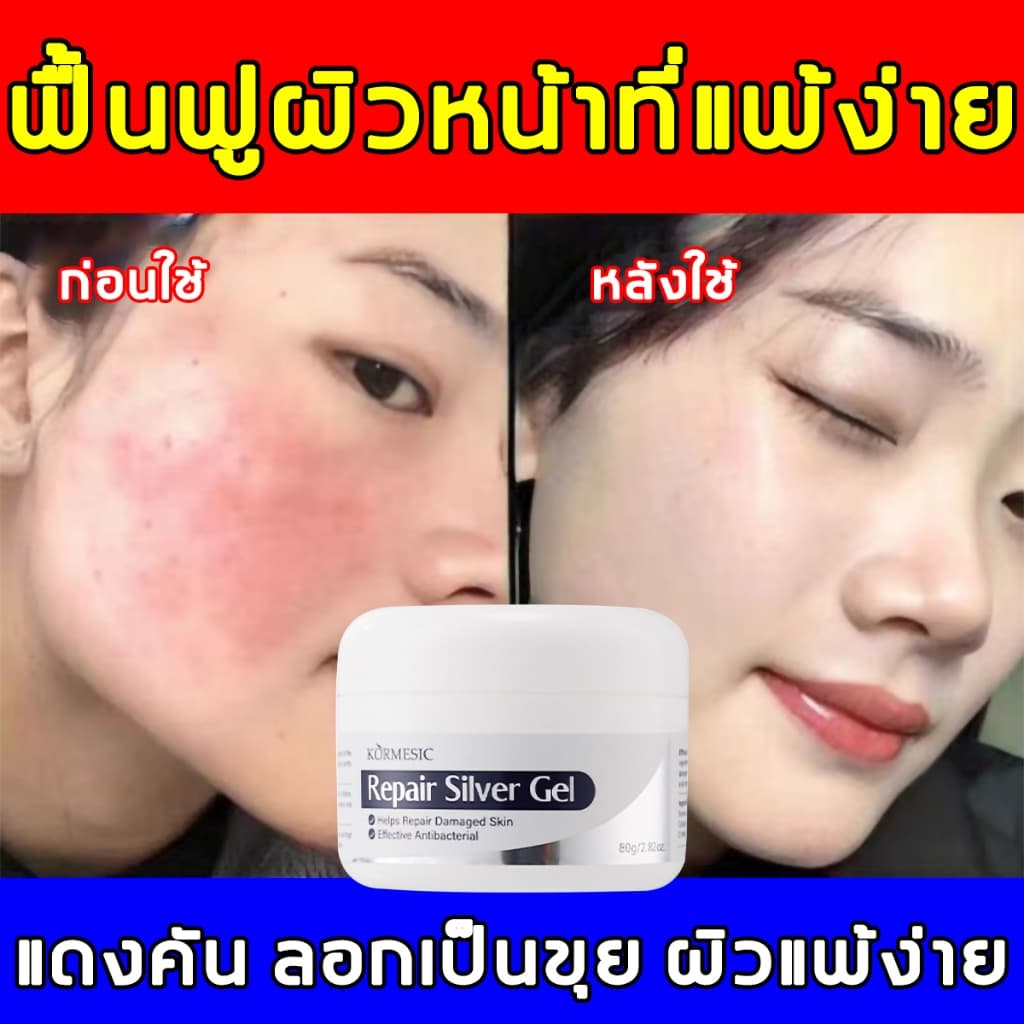 ครีมซ่อมแซมผิว 80g ครีมซ่อมแซมความชุ่มชื้น ซ่อมผิวเบิร์น5วิ สมานแผล สมานผิวอักเสบ ลดรอยแดง ครีมดูแล รูปที่ 1
