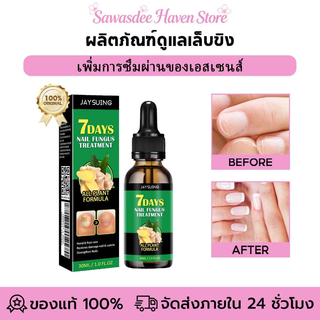 Jaysuing น้ำยารักษาเชื้อราที่เล็บ เซรั่มบำรุงเล็บ เซรั่มเล็บขบ|กำจัดเชื้อราที่เล็บ เล็บฝัง บำรุง… รูปที่ 1