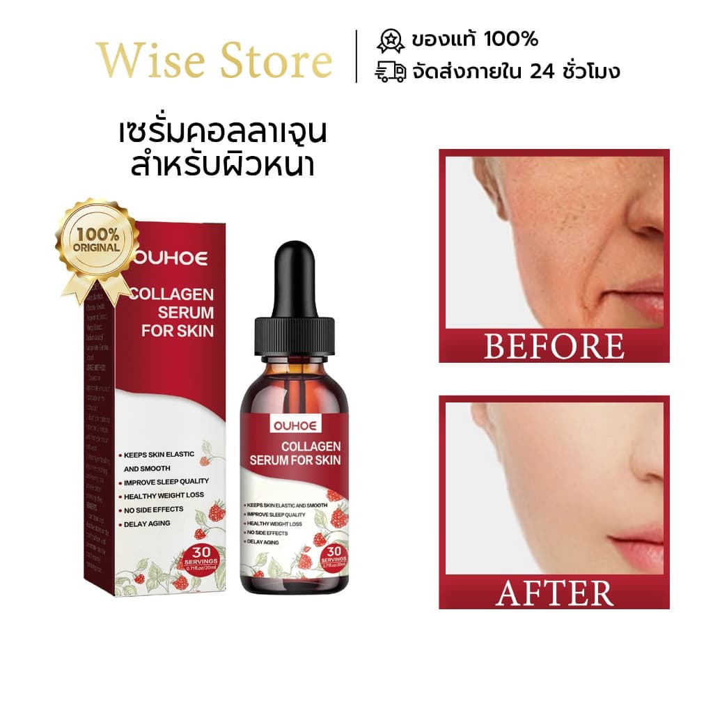 OUHOE เซรั่มคอลลาเจนสำหรับผิวหน้า ลดจุดด่างดำและผ่อนคลายอารมณ์ บำรุงผิว ปรับปรุงการอบแห้ง… รูปที่ 1