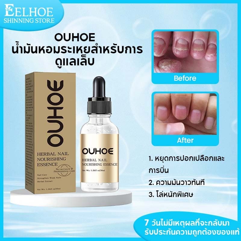 OUHOE เซรั่มบำรุงเล็บ บํารุงเล็บ เชื้อราเล็บ เร่งเล็บยาว น้ำมันหอมระเหยบำรุงเล็บ ท็อปโคทเล็บ 30ml รูปที่ 1
