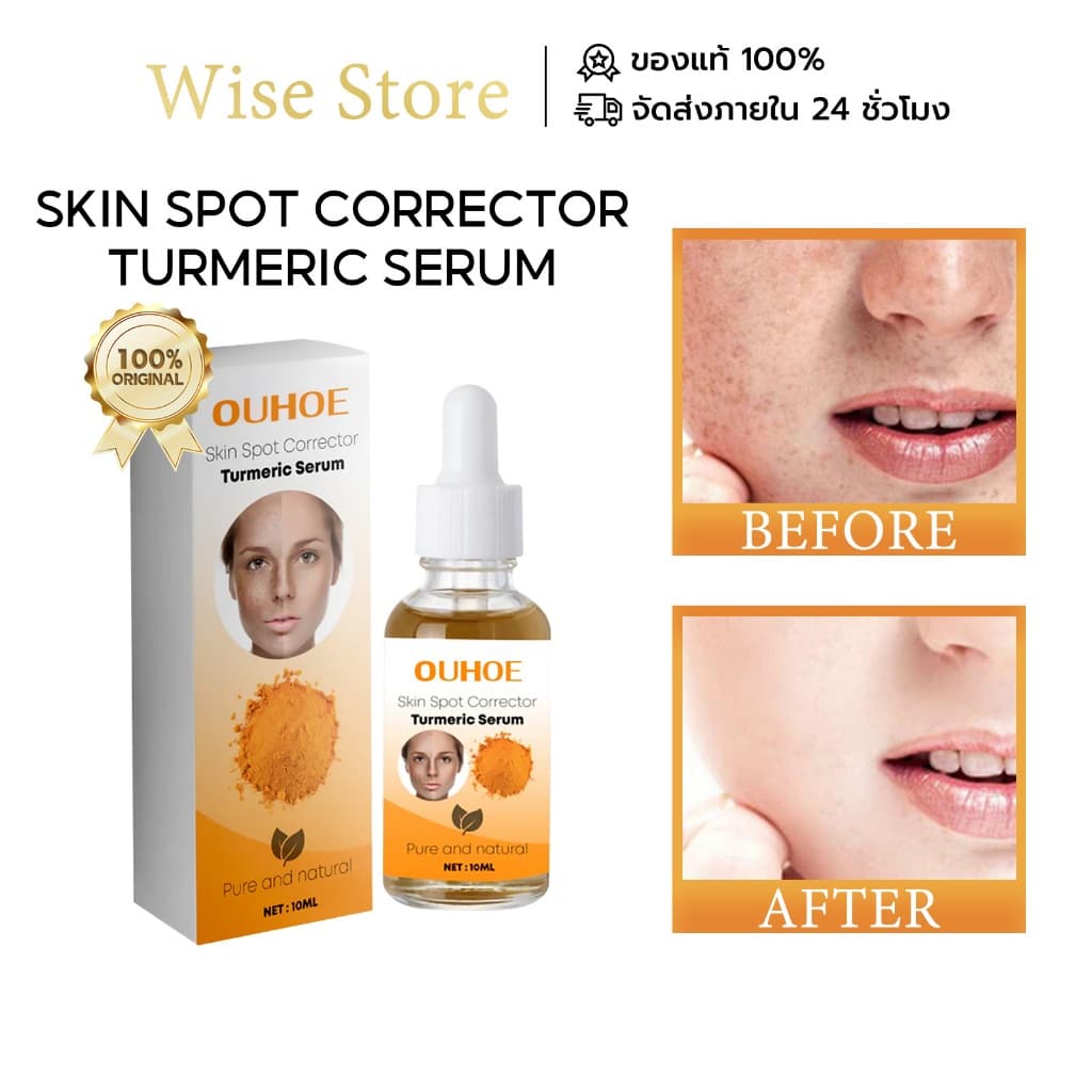 OUHOE turmeric spot removing essence กำจัดจุดด่างดำ ปรับสีผิวให้กระจ่างใส… รูปที่ 1